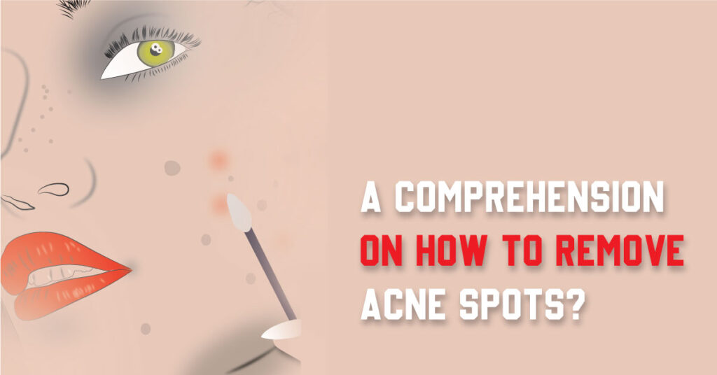 How To Remove Acne Spots