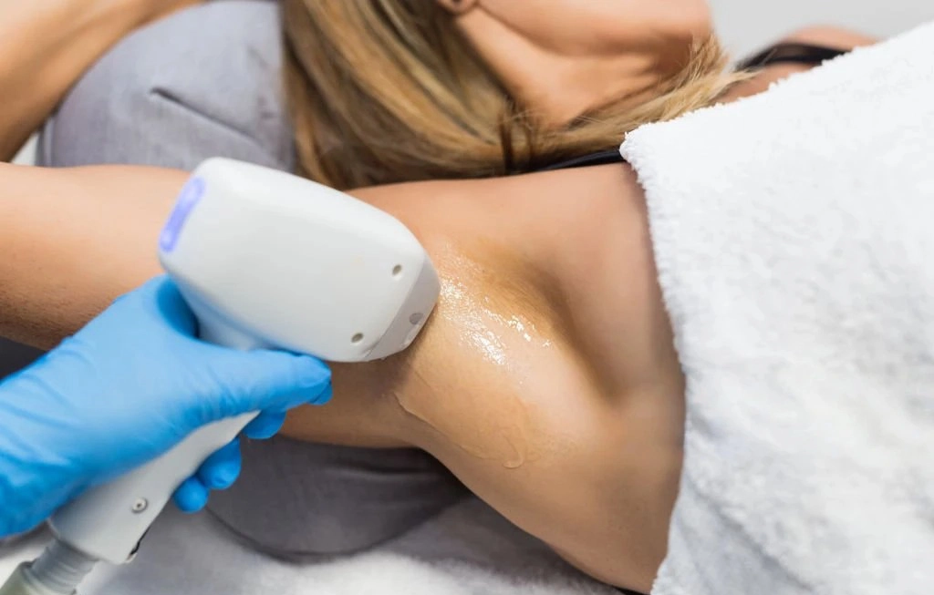 Laser Hair Removal